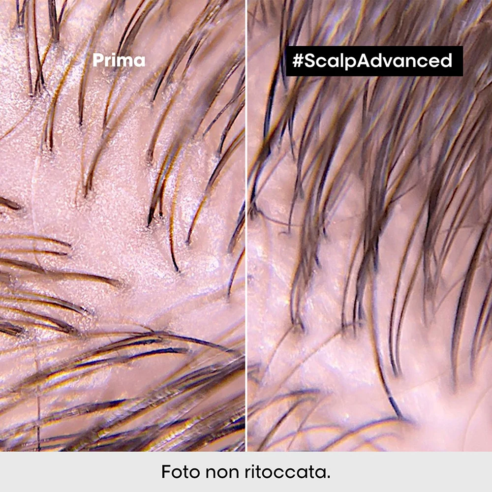 L'oreal Professionnel Scalp Advanced 2-in-1 Deep Purifier Clay Anti-Oiliness 250 ml - Image 4