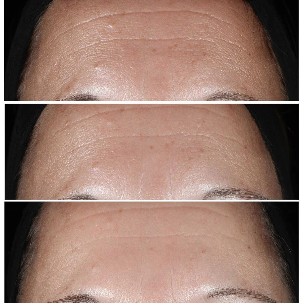 Clinique Smart Clinical Wrinkle Correcting Serum 30 ml - Image 3